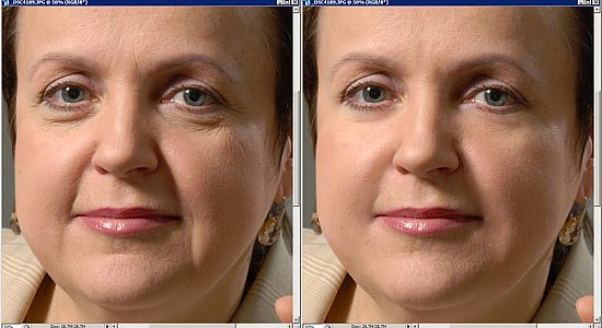 Эффективные способы устранения морщин Эффективные способы устранения морщин