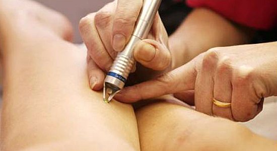 Лазерная коагуляция – спасение ваших ног Лазерная коагуляция – спасение ваших ног