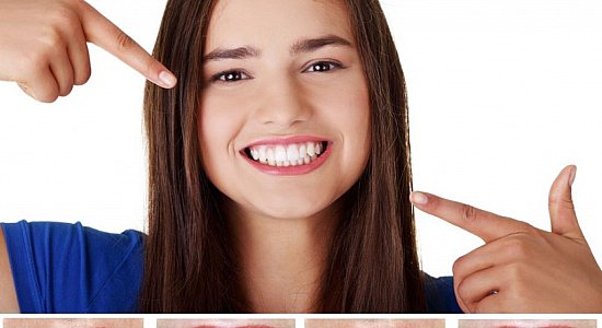 Полезная информация об отбеливании зубов