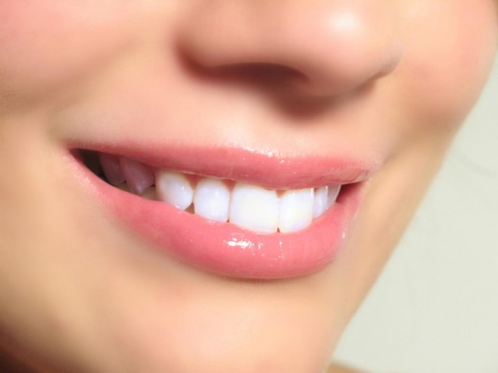 Лазерное отбеливание зубов – гарант успеха1